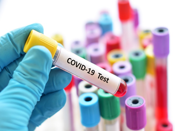 单项核酸检测VIP上门服务 COVID-19 Nucleic Acid RT-PCR Test